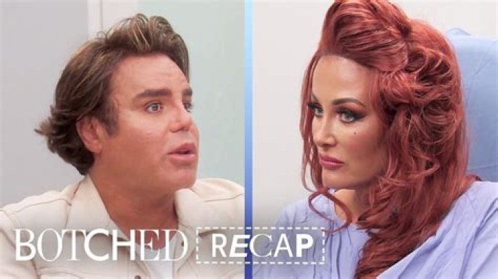Botched Recap 6/25/17: Season 4 Episode 2 “Comic Proportions”